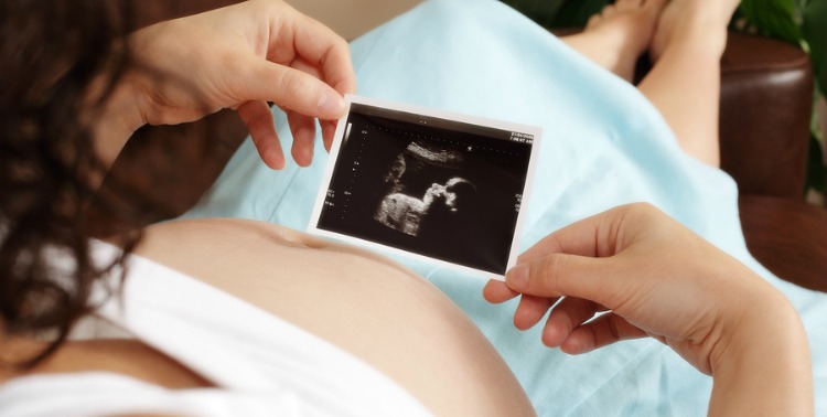Pregnant woman sitting on sofa looking at her unborn baby's ultrasound scan